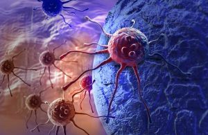 Male Infertility: A Risk Factor for Cancer Development?