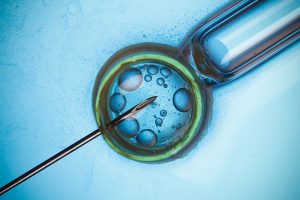The Basics of Intralipid Infusion and the Effects on IVF Treatments