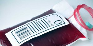 Blutgruppe 0 und der mögliche Zusammenhang zu Fruchtbarkeitsstörungen