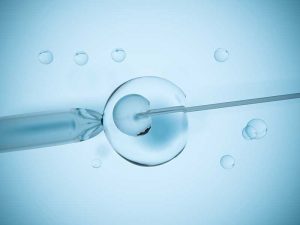 What to Expect Your First Time Receiving IVF Treatment