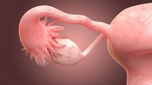 3-D Printed Ovaries to Restore Fertility  1