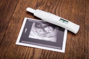 Jede Frau wird anders schwanger 1