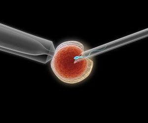 IVF bei männlicher Unfruchtbarkeit