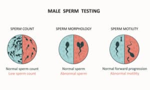 Wie oft sollte man sein Sperma bei unerfülltem Kinderwunsch untersuchen lassen? 1